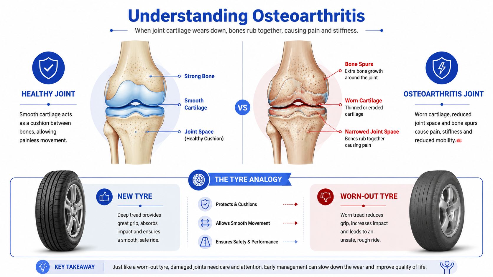 A diagram comparing a healthy joint to an osteoarthritic joint using a car tyre analogy for illustration.