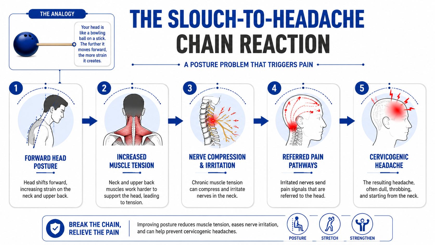 An infographic showing the five steps from poor forward head posture to chronic cervicogenic headaches.