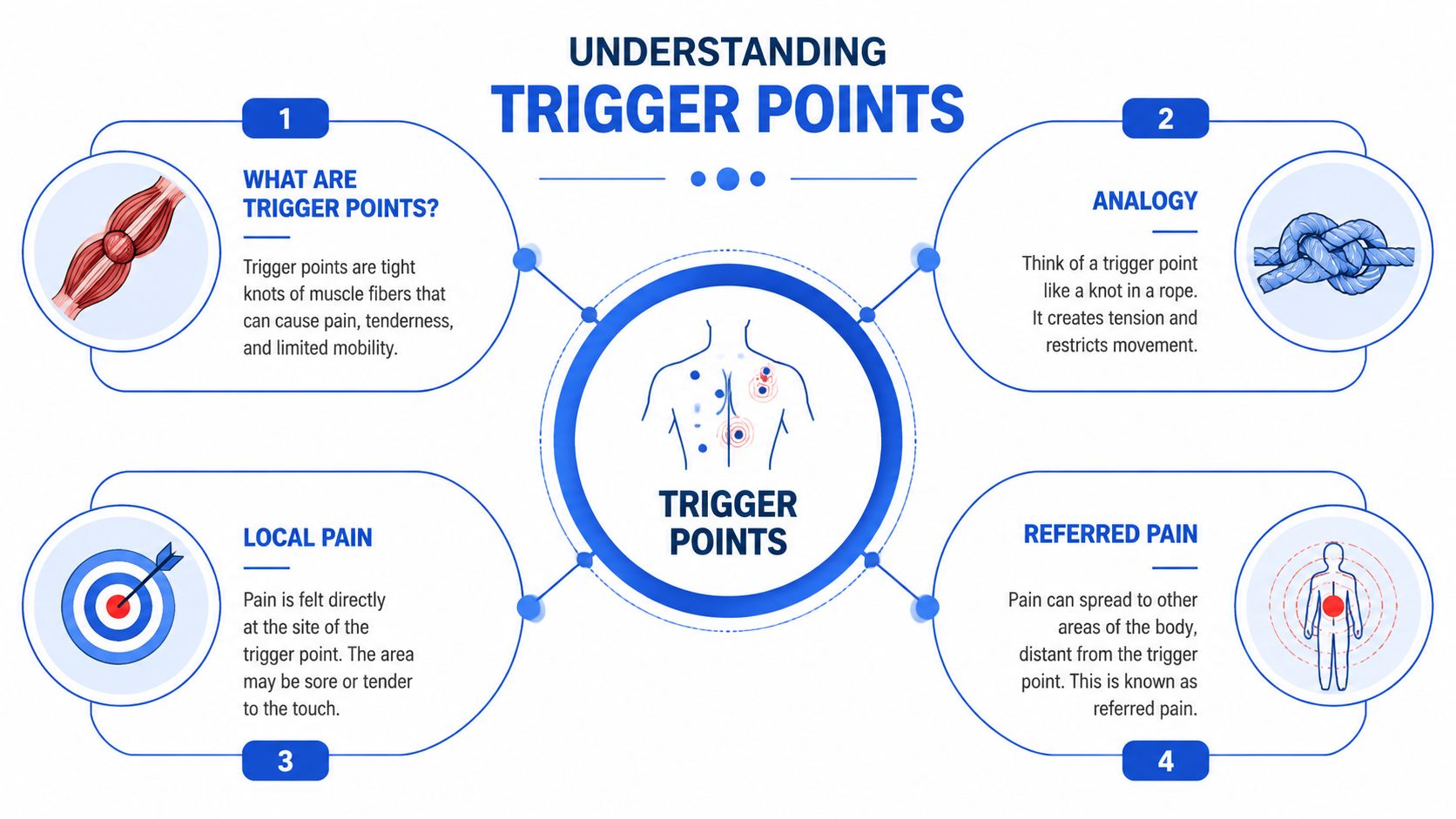 An infographic explaining trigger points, showing muscle knots, an analogy, local pain, and referred pain diagrams.