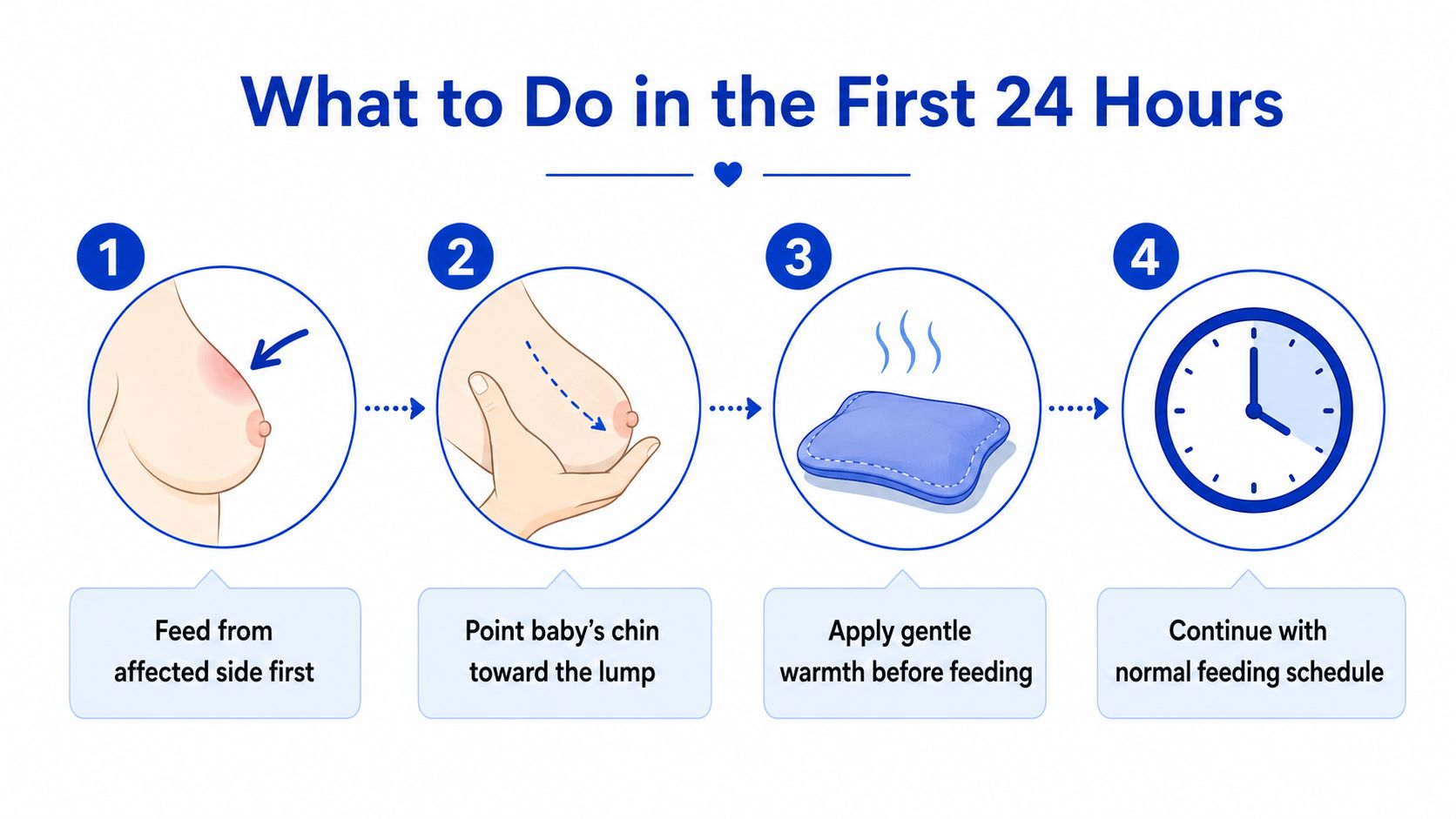 An infographic showing four steps to manage a blocked milk duct during the first 24 hours.
