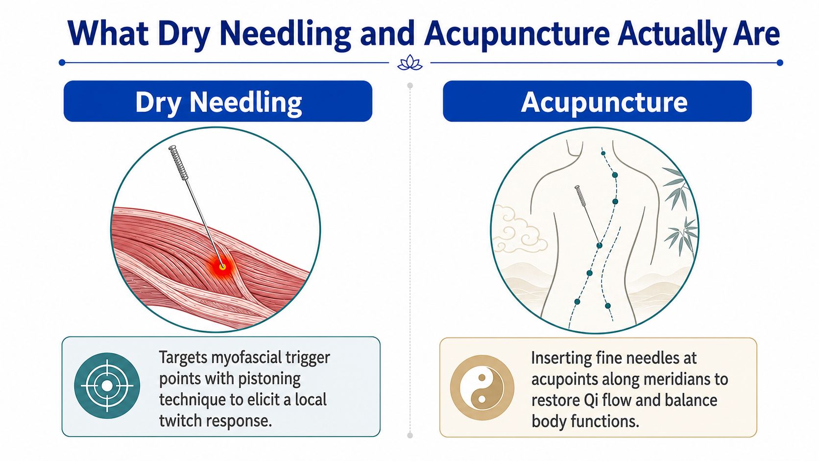 An infographic comparing dry needling on muscle trigger points to acupuncture on meridians for balance and Qi flow.